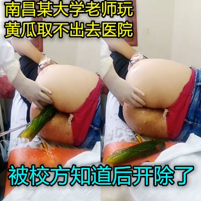 真实南昌一骚女往肛门塞黄瓜无法拔出被送到医院取出}